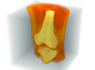 3D Image Processing in Mathematica 10